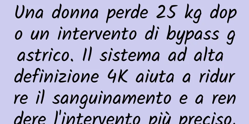 Una donna perde 25 kg dopo un intervento di bypass gastrico. Il sistema ad alta definizione 4K aiuta a ridurre il sanguinamento e a rendere l'intervento più preciso.