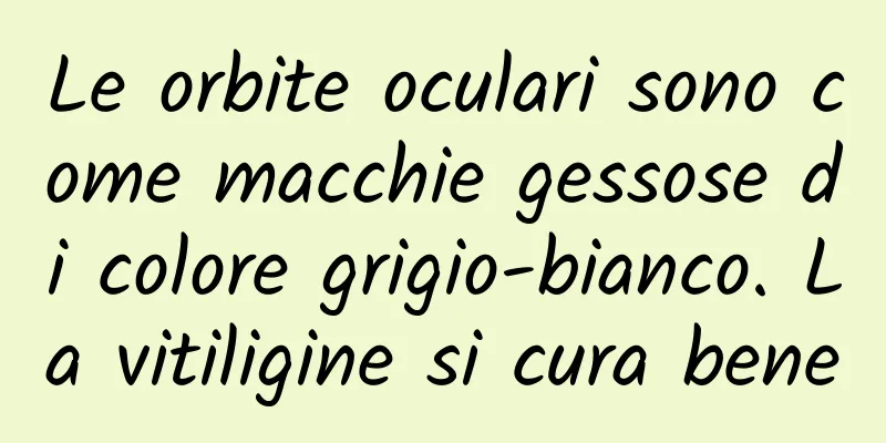 Le orbite oculari sono come macchie gessose di colore grigio-bianco. La vitiligine si cura bene
