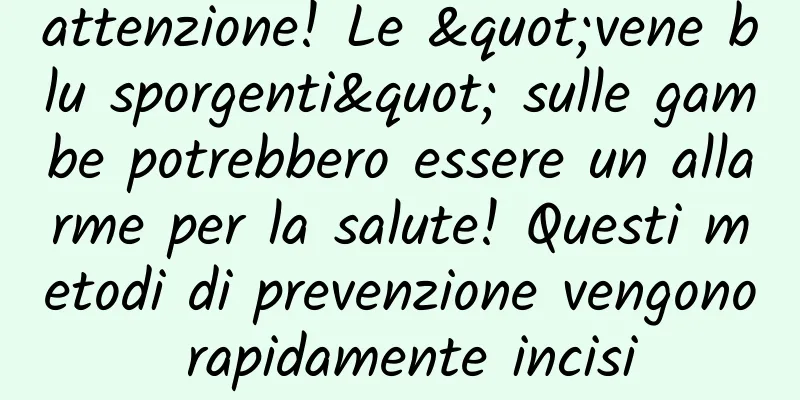 attenzione! Le "vene blu sporgenti" sulle gambe potrebbero essere un allarme per la salute! Questi metodi di prevenzione vengono rapidamente incisi
