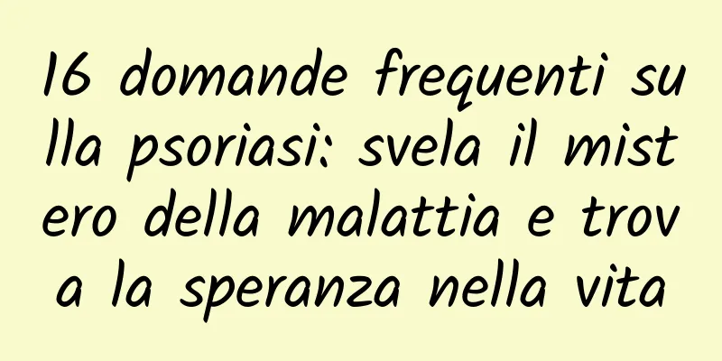16 domande frequenti sulla psoriasi: svela il mistero della malattia e trova la speranza nella vita