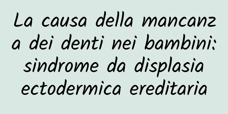 La causa della mancanza dei denti nei bambini: sindrome da displasia ectodermica ereditaria