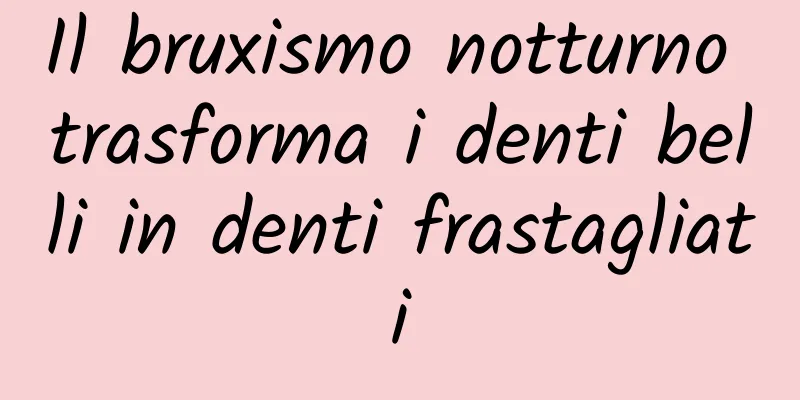 Il bruxismo notturno trasforma i denti belli in denti frastagliati