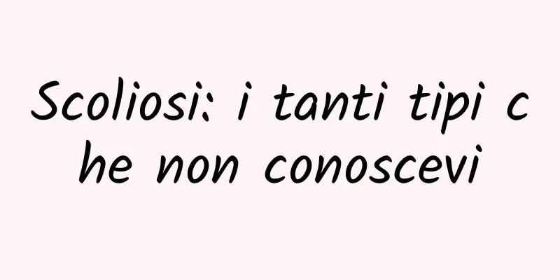 Scoliosi: i tanti tipi che non conoscevi