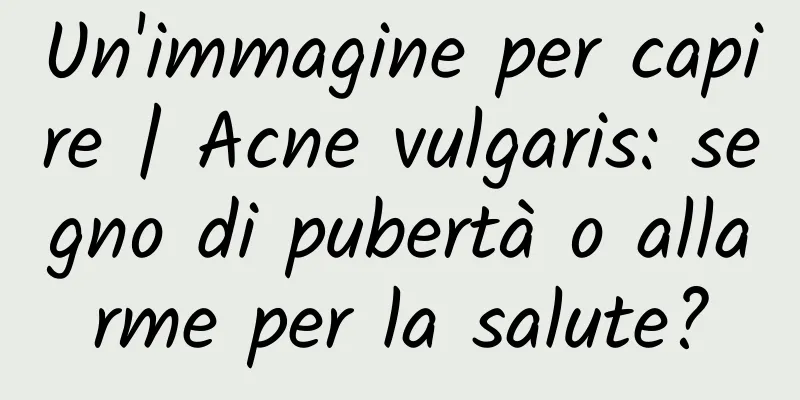 Un'immagine per capire | Acne vulgaris: segno di pubertà o allarme per la salute?