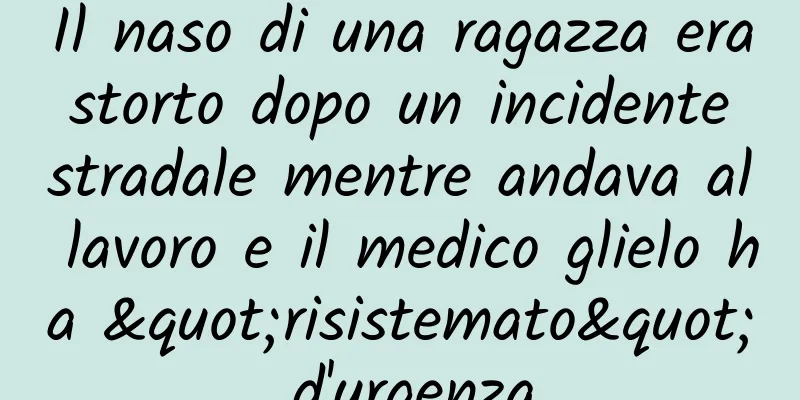 Il naso di una ragazza era storto dopo un incidente stradale mentre andava al lavoro e il medico glielo ha "risistemato" d'urgenza
