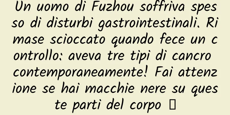 Un uomo di Fuzhou soffriva spesso di disturbi gastrointestinali. Rimase scioccato quando fece un controllo: aveva tre tipi di cancro contemporaneamente! Fai attenzione se hai macchie nere su queste parti del corpo →