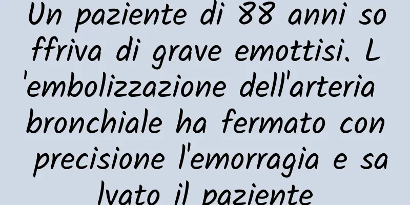 Un paziente di 88 anni soffriva di grave emottisi. L'embolizzazione dell'arteria bronchiale ha fermato con precisione l'emorragia e salvato il paziente