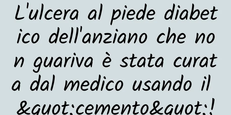 L'ulcera al piede diabetico dell'anziano che non guariva è stata curata dal medico usando il "cemento"!