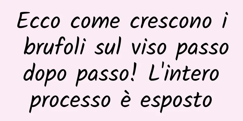 Ecco come crescono i brufoli sul viso passo dopo passo! L'intero processo è esposto