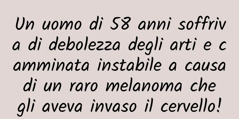 Un uomo di 58 anni soffriva di debolezza degli arti e camminata instabile a causa di un raro melanoma che gli aveva invaso il cervello!