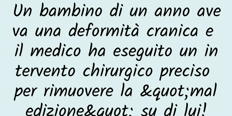 Un bambino di un anno aveva una deformità cranica e il medico ha eseguito un intervento chirurgico preciso per rimuovere la "maledizione" su di lui!