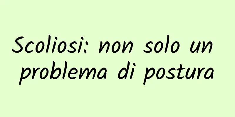 Scoliosi: non solo un problema di postura