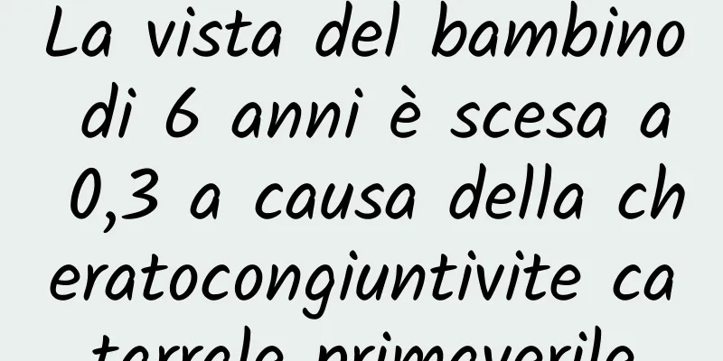 La vista del bambino di 6 anni è scesa a 0,3 a causa della cheratocongiuntivite catarrale primaverile