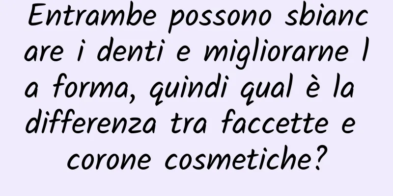 Entrambe possono sbiancare i denti e migliorarne la forma, quindi qual è la differenza tra faccette e corone cosmetiche?
