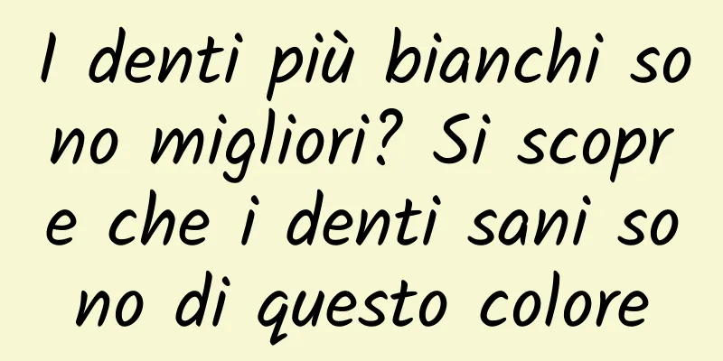I denti più bianchi sono migliori? Si scopre che i denti sani sono di questo colore