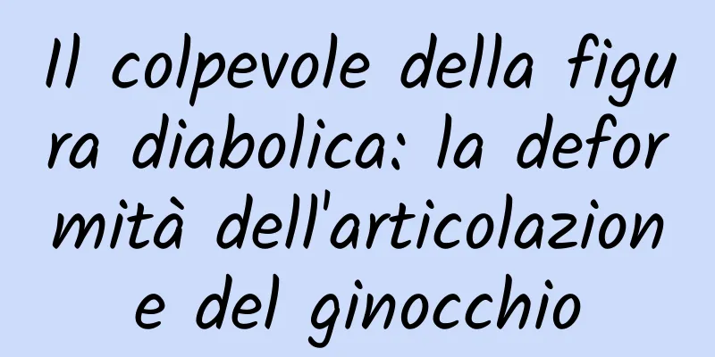 Il colpevole della figura diabolica: la deformità dell'articolazione del ginocchio