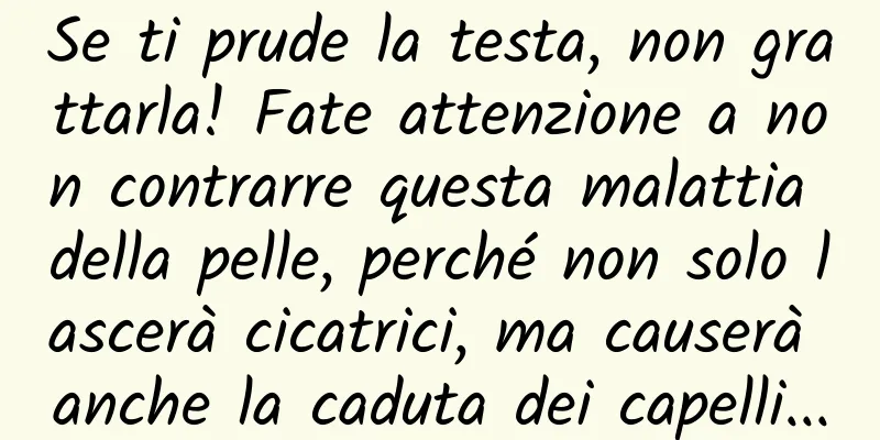 Se ti prude la testa, non grattarla! Fate attenzione a non contrarre questa malattia della pelle, perché non solo lascerà cicatrici, ma causerà anche la caduta dei capelli...