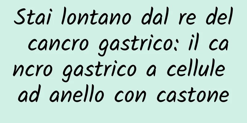 Stai lontano dal re del cancro gastrico: il cancro gastrico a cellule ad anello con castone