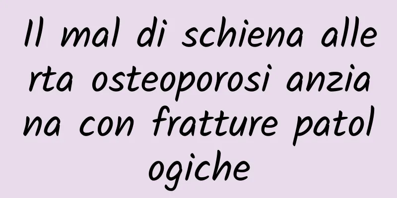Il mal di schiena allerta osteoporosi anziana con fratture patologiche