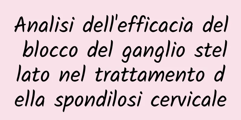 Analisi dell'efficacia del blocco del ganglio stellato nel trattamento della spondilosi cervicale