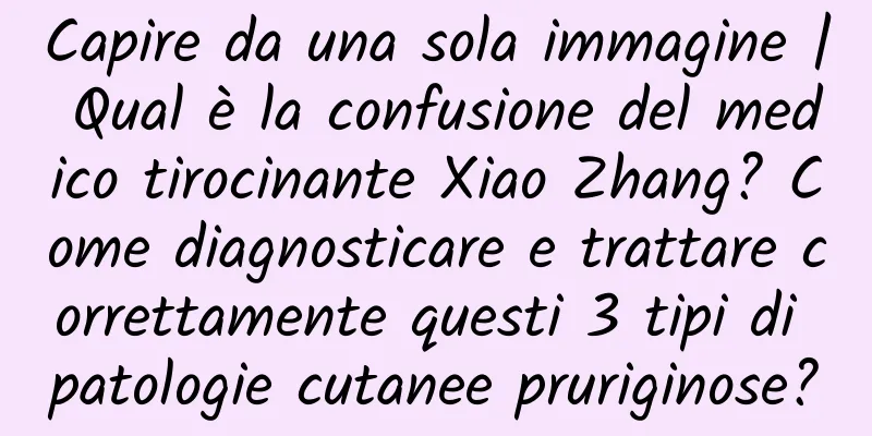 Capire da una sola immagine | Qual è la confusione del medico tirocinante Xiao Zhang? Come diagnosticare e trattare correttamente questi 3 tipi di patologie cutanee pruriginose?