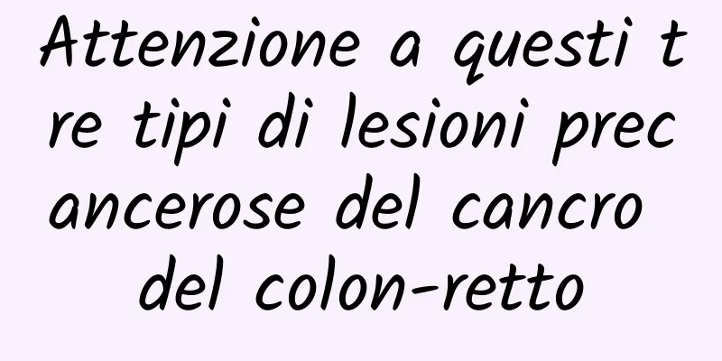 Attenzione a questi tre tipi di lesioni precancerose del cancro del colon-retto