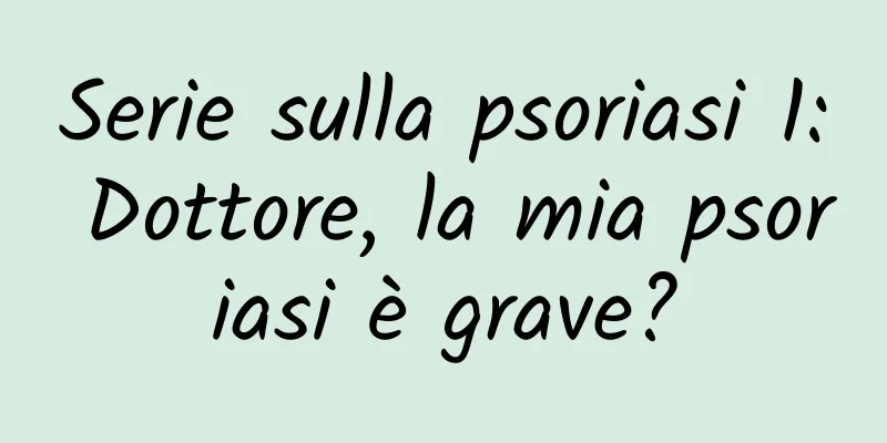 Serie sulla psoriasi 1: Dottore, la mia psoriasi è grave?