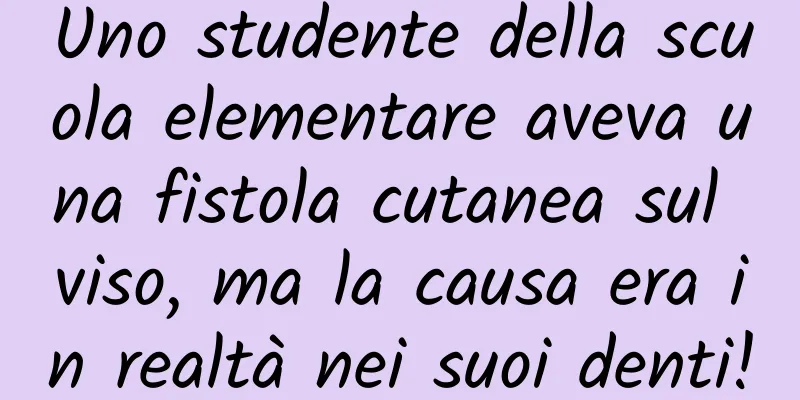 Uno studente della scuola elementare aveva una fistola cutanea sul viso, ma la causa era in realtà nei suoi denti!