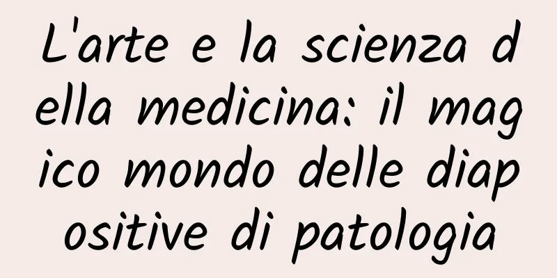 L'arte e la scienza della medicina: il magico mondo delle diapositive di patologia