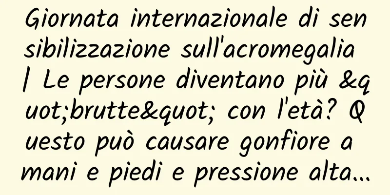 Giornata internazionale di sensibilizzazione sull'acromegalia | Le persone diventano più "brutte" con l'età? Questo può causare gonfiore a mani e piedi e pressione alta...