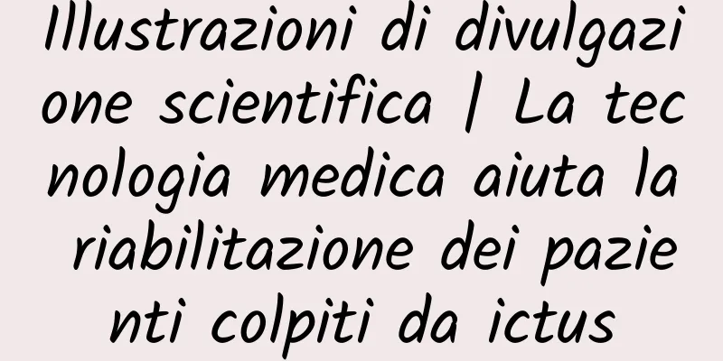 Illustrazioni di divulgazione scientifica | La tecnologia medica aiuta la riabilitazione dei pazienti colpiti da ictus