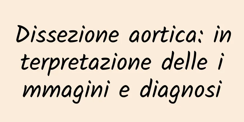 Dissezione aortica: interpretazione delle immagini e diagnosi