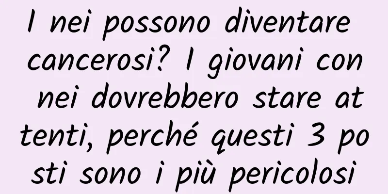 I nei possono diventare cancerosi? I giovani con nei dovrebbero stare attenti, perché questi 3 posti sono i più pericolosi