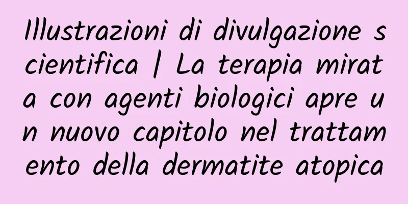 Illustrazioni di divulgazione scientifica | La terapia mirata con agenti biologici apre un nuovo capitolo nel trattamento della dermatite atopica