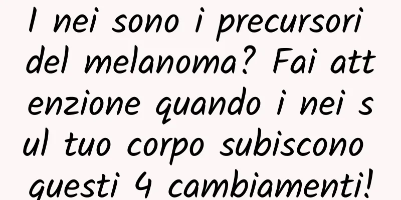 I nei sono i precursori del melanoma? Fai attenzione quando i nei sul tuo corpo subiscono questi 4 cambiamenti!