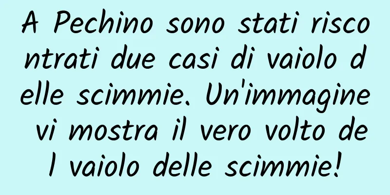 A Pechino sono stati riscontrati due casi di vaiolo delle scimmie. Un'immagine vi mostra il vero volto del vaiolo delle scimmie!
