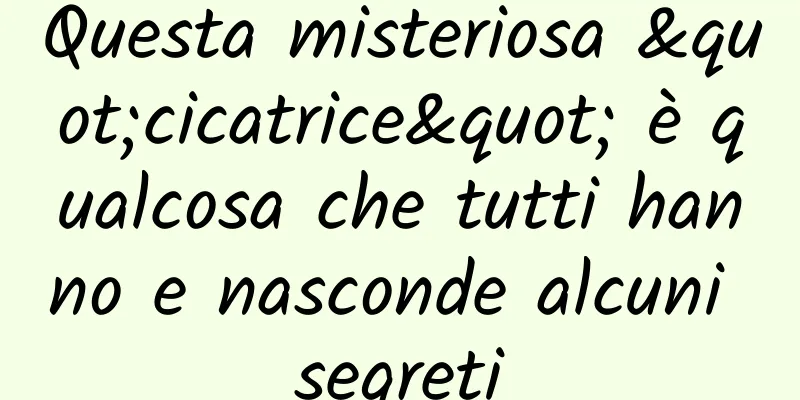 Questa misteriosa "cicatrice" è qualcosa che tutti hanno e nasconde alcuni segreti