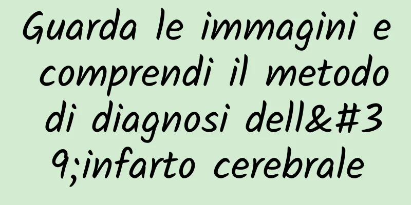 Guarda le immagini e comprendi il metodo di diagnosi dell'infarto cerebrale