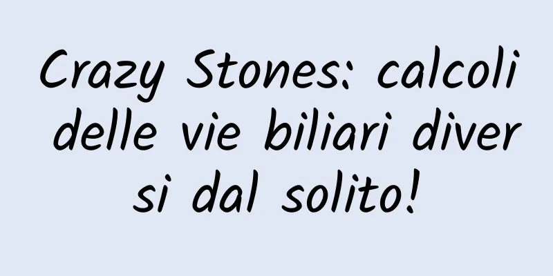 Crazy Stones: calcoli delle vie biliari diversi dal solito!