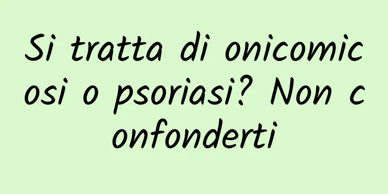 Si tratta di onicomicosi o psoriasi? Non confonderti
