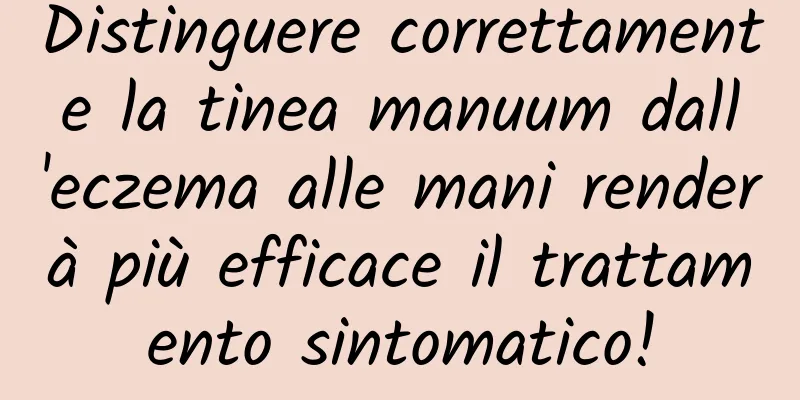 Distinguere correttamente la tinea manuum dall'eczema alle mani renderà più efficace il trattamento sintomatico!