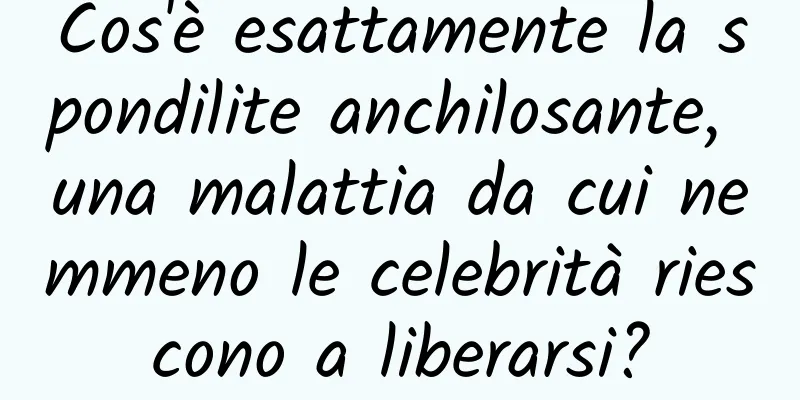 Cos'è esattamente la spondilite anchilosante, una malattia da cui nemmeno le celebrità riescono a liberarsi?