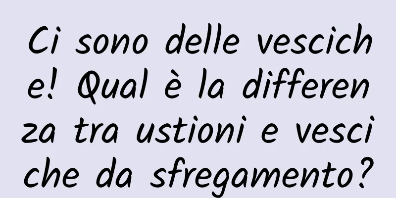 Ci sono delle vesciche! Qual è la differenza tra ustioni e vesciche da sfregamento?