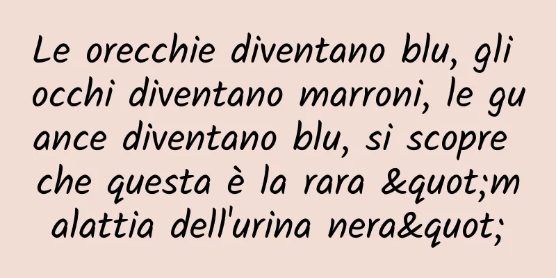 Le orecchie diventano blu, gli occhi diventano marroni, le guance diventano blu, si scopre che questa è la rara "malattia dell'urina nera"