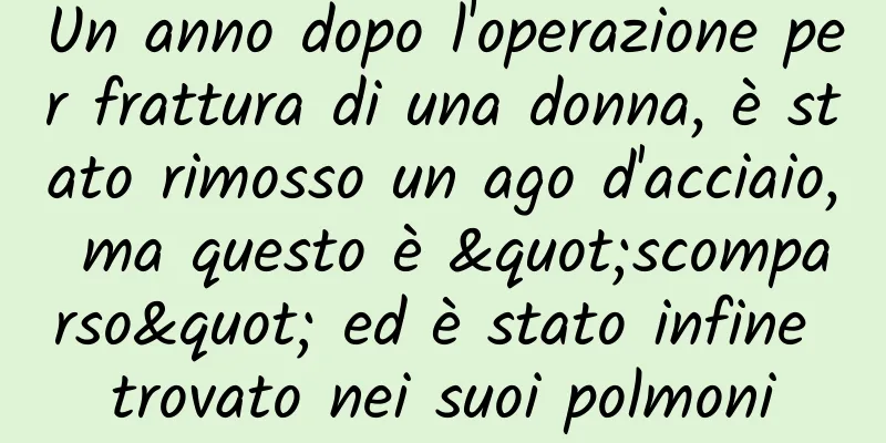 Un anno dopo l'operazione per frattura di una donna, è stato rimosso un ago d'acciaio, ma questo è "scomparso" ed è stato infine trovato nei suoi polmoni