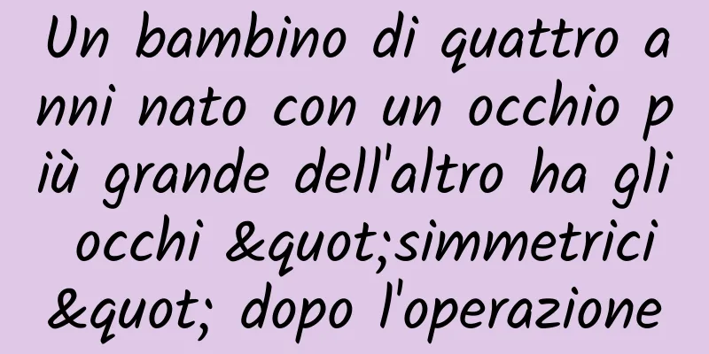Un bambino di quattro anni nato con un occhio più grande dell'altro ha gli occhi "simmetrici" dopo l'operazione