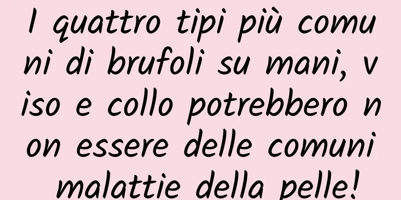 I quattro tipi più comuni di brufoli su mani, viso e collo potrebbero non essere delle comuni malattie della pelle!