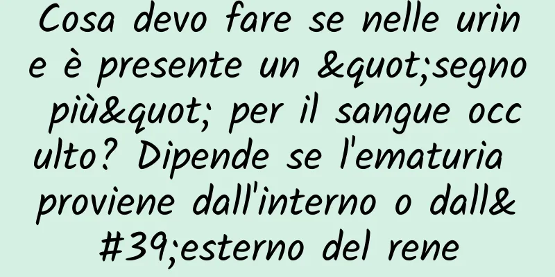 Cosa devo fare se nelle urine è presente un "segno più" per il sangue occulto? Dipende se l'ematuria proviene dall'interno o dall'esterno del rene