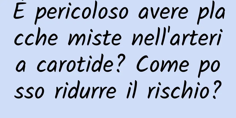 È pericoloso avere placche miste nell'arteria carotide? Come posso ridurre il rischio?