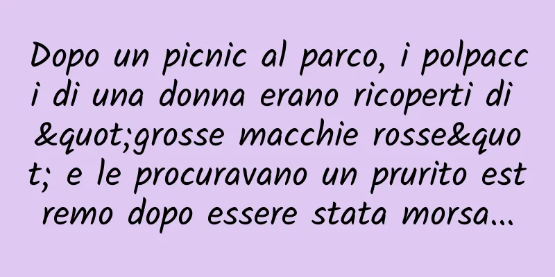 Dopo un picnic al parco, i polpacci di una donna erano ricoperti di "grosse macchie rosse" e le procuravano un prurito estremo dopo essere stata morsa...